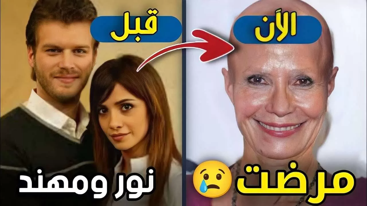 لن تصدق كيف أصبح شكل أبطال المسلسل التركي نور ومهند jpg